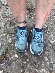 28467674_10213769218536590_1474283203784216222_n